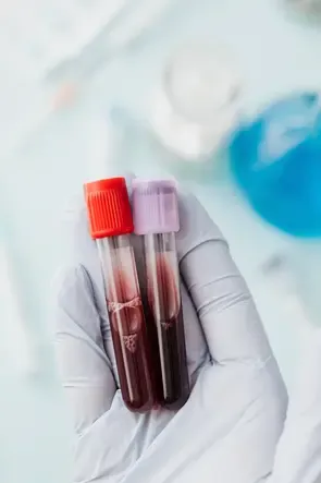 Analize hematologie la Policlinica Euromed Ploiești