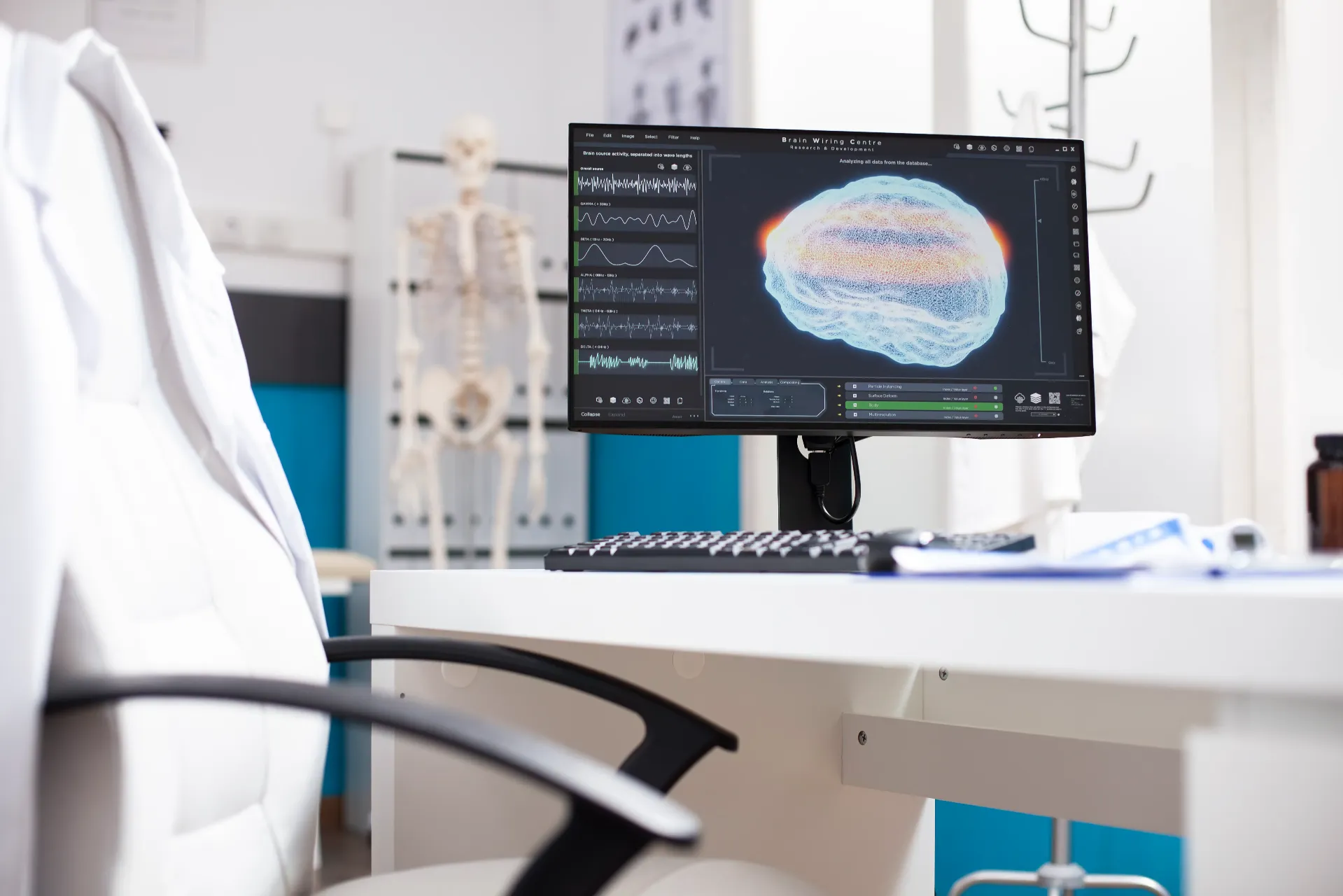 Consultație neurologie cu analiză imagistică cerebrală la Euromed Ploiești